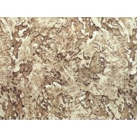 Ковролин 3,5 м р2096/а2р/103 (В) (70 кв.м.) Ковролин 3,5 м р2096/а2р/103 (В) (70 кв.м.)